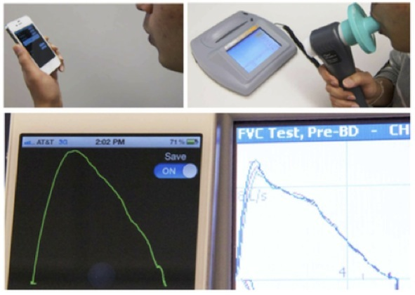 SpiroSmart: the mobile spirometer